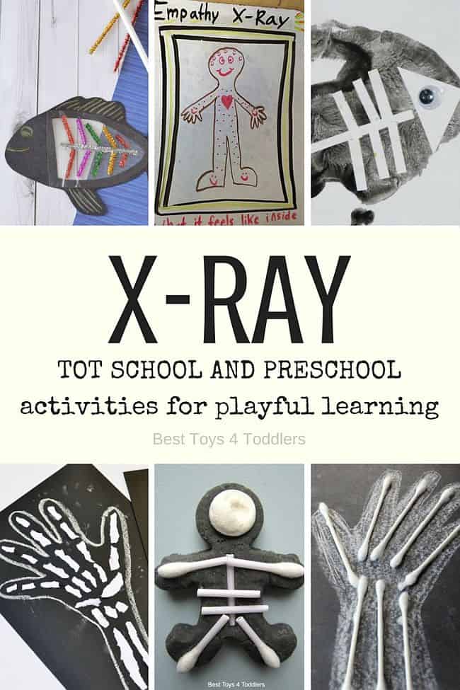 Best Toys 4 Toddlers - letter X for X-ray - 7 days of preplanned activities for tot school and preschool